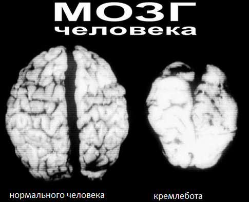 0fed0f3f6d9b2af29254fec9ea2.png