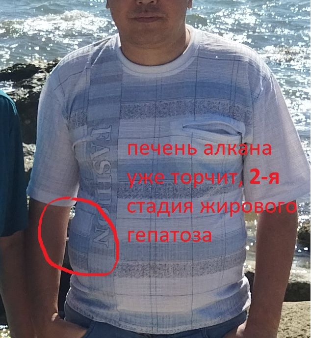 alkan.jpg