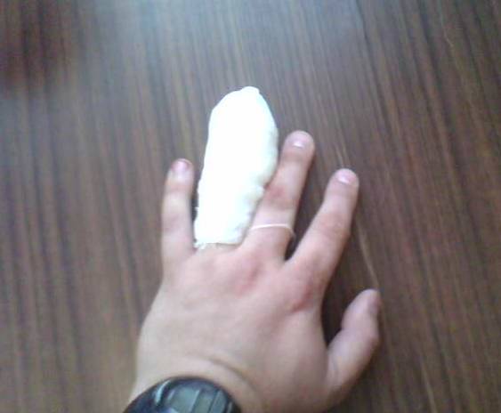 finger.jpg