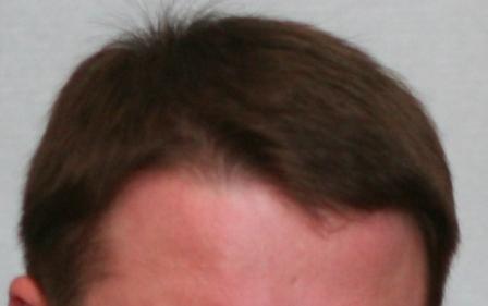 hair.jpg