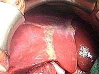 liver_normal.jpeg